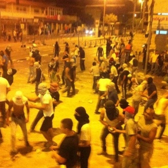 مستوطنون يصيبون 5 مقدسيون بينهم فتاة