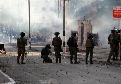 إصابة شاب مقدسي بحروق في اعتداء من قبل مستوطنات