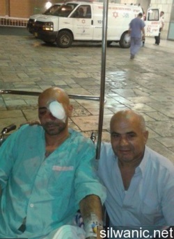 استئصال عين مقدسي بعد إصابته بعيار مطاطي