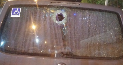 استئصال عين شاب أصيب خلال مواجهات بالقدس