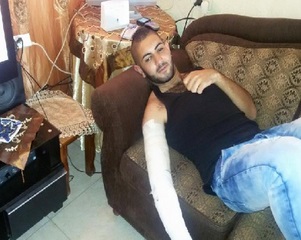 160 مصابا في المواجهات المتواصلة مع قوات الاحتلال في القدس المحتلة