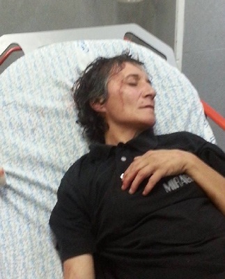 اصابة مقدسية جراء تعرضها للاعتداء وطفل برصاص مطاطي في الراس