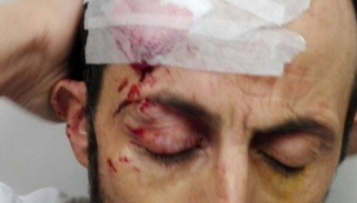 إصابة مواطن وزوجته برصاص “مطاطي” في العيسوية