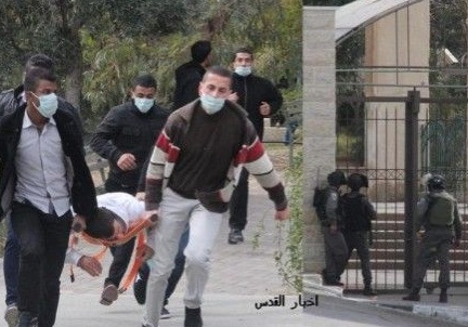 إصابة 21 طالبا في جامعة القدس بالمطاط وعشرات حالات الاختناق
